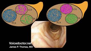 Laryngeal Nerve Palsy or Paralysis Anatomy physiology classification causes pathophysiology [upl. by Kutzenco376]