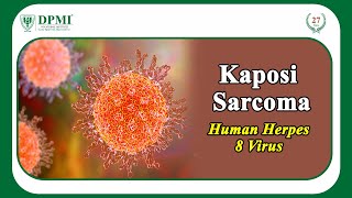 Kaposi Sarcoma What is Kaposi Sarcoma Signs and Symptoms of Kaposi Sarcoma KSHV Virus Cancer [upl. by Aihn]