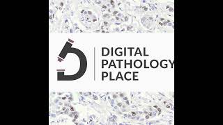 88 Artificial Intelligence amp Machine Learning Transforming Pathology  Webinar [upl. by Yrag]