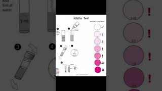 Nitrite Test [upl. by Ecirtemed]