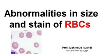 Abnormal size and stain of RBCs [upl. by Aisined]