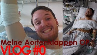 VLOG 0  Meine Aortenklappen OP und wie es mir so erging [upl. by Lilias424]