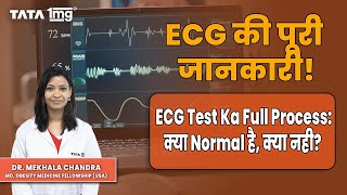 ECG Test in India Procedure Cost Normal Values [upl. by Kronick380]