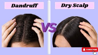 DANDRUFF VS DRY SCALP How To Spot the Difference [upl. by Aneem23]