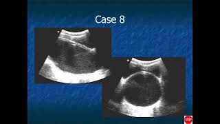 RADIOLOGY EXAM CASES [upl. by Ramsey]