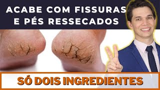 ACABE COM AS RACHADURAS NOS PÉS com apenas 2 Ingredientes e Deixe os Pés Macios [upl. by Annanhoj]