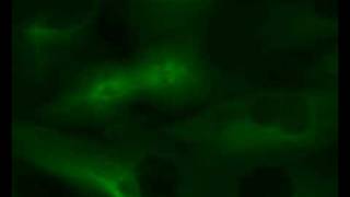 Mitosis  GFP microtubules in LLCPK1 cells [upl. by Laurin]