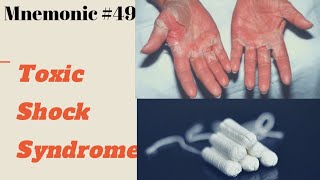 TOXIC SHOCK SYNDROME Mnemonic [upl. by Mellette]