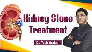 Treatment for KIDNEY STONE  Unani Treatments 2019 [upl. by Barnet579]