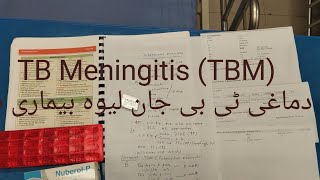 Tuberculous Meningitis TBM CF amp managment دماغی ٹی بی جان لیوہ بیماری ہے [upl. by Dutch]