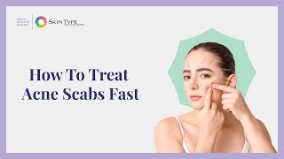 How to Heal Acne Scabs Fast and Easy with Dr Leslie Baumann [upl. by Dekow]