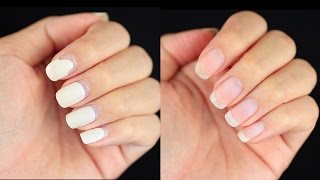 How to Remove Gel Nails at Home DamageFree [upl. by Aikemat]