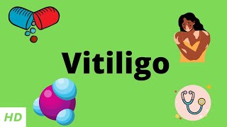 Vitiligo Causes Signs and Symptoms Diagnosis and Treatment [upl. by Xylia]