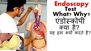 Endoscopy test in Hindi [upl. by Esirrehc961]