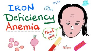 Iron Deficiency Anemia  All you need to know  Causes Symptoms Diagnosis Treatment [upl. by Piks934]