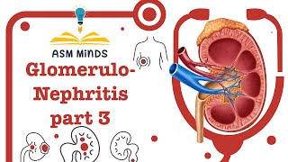 Glomerulonephritis GN part 3 Nephritc syndrome by ASM Minds [upl. by Ahseekat]