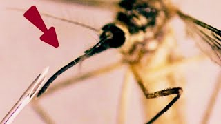 A closer look at Mosquito under the microscope Zoomphilic [upl. by Licko]