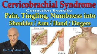 Cervicobrachial Syndrome Corrective Exercise Pain Burning into Shoulder Arm Hand  Dr Mandell [upl. by Derinna]