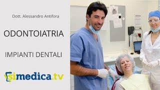 IMPLANTOLOGIA DENTALE Tutto quello che cè da sapere in 10 domande [upl. by Ahsenav]