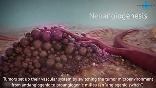 Tumor growth  3D medical animation [upl. by Georgina486]