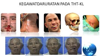 KEGAWATDARURATAN PADA THTKL [upl. by Anitsrik]