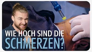 Wie SCHMERZHAFT ist eine Haartransplantation [upl. by Millburn]