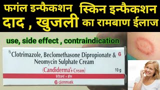 candiderma plus cream use  fungal infection daad khaj khujli ki dawa  skin infection treatment [upl. by Doomham]