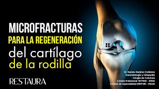 Microfracturas para la regeneración del cartílago de la rodilla [upl. by Irpac]