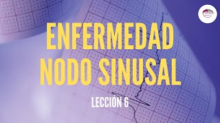 6 ENFERMEDAD NODO SINUSAL ELECTROCARDIOGRAFÍA [upl. by Leba]