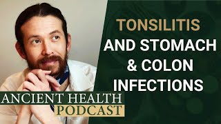 Chronic Tonsillitis and Its Relationship to Hidden Stomach and Colon Infections [upl. by Steck237]