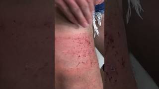 Peeling my Skin OFF with SANDPAPER NUNCHUCKS… funny experiment martialarts [upl. by Ahtenak489]