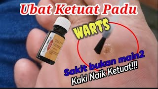 UBAT KETUAT MURAH BELI DARI FARMASI  MADICINE FOR WARTS  SAKIT KAKI KERNA KETUAT [upl. by Stoecker]