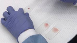 Making and staining blood smears [upl. by Noorah]