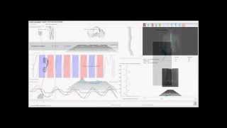 DIERS 4D motion® Lab  Analysis of Spine Leg axis Foot pressure in one compact system [upl. by Atirec832]