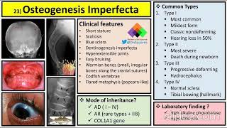 Osteogenesis imperfecta clinical features diagnosis and management [upl. by Annohs]