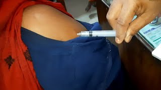 Arm injection IM Soma Ject Injection Push √√ Injection Video  জন্মবিরতিকরণ ইনজেকশন 24 Ep10 [upl. by Otilia]