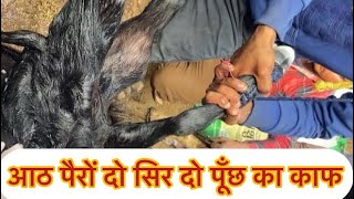 Difficulty in birth l conjoined twins l Dystocia l कठिन प्रसव l Dr Umar Khan [upl. by Katya]