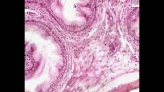 Shotgun Histology Epididymis [upl. by Enogitna271]