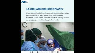 Laser Haemorrhoidoplasty Surgery LHP [upl. by Westfahl]