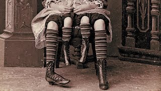 The Story Of Myrtle Corbin The Real Four Legged Girl [upl. by Argyres]