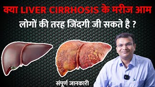 क्या Liver Cirrhosis के मरीज आम लोगों की तरह जिंदगी जी सकते है   क्या सिरोसिस ठीक हो सकता है [upl. by Norwood]