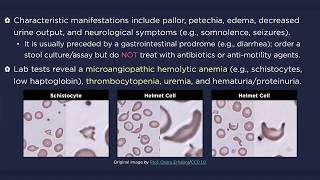 Hemolytic Uremic Syndrome HUS [upl. by Fitzhugh]