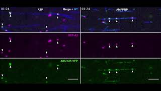 Microtubulebased transport of intracellular virion particles [upl. by Lyrradal]