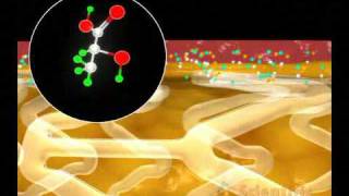 Cardiology  Drug Eluting Stent [upl. by Kokoruda646]