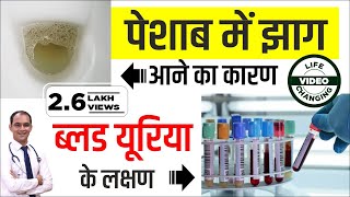 Proteinuria Treatment in Ayurveda  Protein in Urine Symptoms  पेशाब में खून या झाग आने का कारण [upl. by Diao]