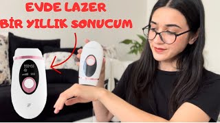 XIAOMI İNFACE İPL 1 YILLIK SONUCUM evdelazer [upl. by Aelanna]