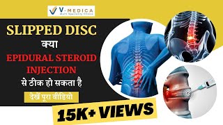 Lumbar Epidural Steroid Injection For Slipped Disc  Dr Ashish Yadav  Spine Surgeon [upl. by Gauldin]