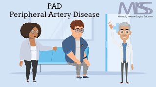 All You Should Know About Peripheral Artery DiseasePAD  MISS  San Jose [upl. by Llerot]