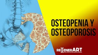 Osteopenia y Osteoporosis [upl. by Reis904]