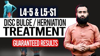 Get Rid Of L4 L5 And L5 S1 Disc Bulge With This Home Treatment  Guaranteed Results [upl. by Eilyk849]